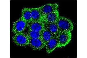 Confocal immunofluorescent analysis of Hamartin antibody with HeLa cells followed by Alexa Fluor 488-conjugated goat anti-rabbit lgG (green). (TSC1 antibody  (AA 401-430))