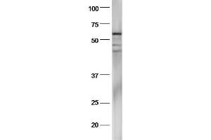 Mouse stomach lysates probed with Anti-pan-Cytokeratin Polyclonal Antibody, Unconjugated  at 1:5000 90min in 37˚C. (Cytokeratin 1 antibody  (AA 101-200))