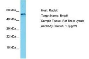 Image no. 1 for anti-Bone Morphogenetic Protein 5 (BMP5) (AA 327-376) antibody (ABIN6750503) (BMP5 antibody  (AA 327-376))