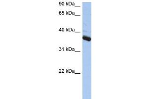 Western Blotting (WB) image for anti-Budding Uninhibited By Benzimidazoles 3 Homolog (Yeast) (BUB3) (N-Term) antibody (ABIN2787758)