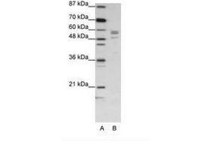Image no. 1 for anti-Serine--tRNA Ligase, Cytoplasmic-Like (C-Term) antibody (ABIN202697) (Serine--tRNA Ligase, Cytoplasmic-Like (C-Term) antibody)