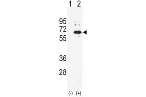 Western blot analysis of Alkaline Phosphatase antibody and 293 cell lysate (2 ug/lane) either nontransfected (Lane 1) or transiently transfected (2) with the ALPL gene. (ALPL antibody  (AA 217-246))