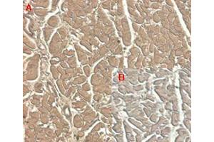 Immunohistochemical staining of human tissue using anti-ST2 (human), mAb (ST33868)  at 1:100 dilution. (IL1RL1 antibody)