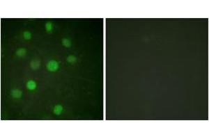 Immunofluorescence analysis of HuvEc cells, using Histone H1 (Ab-17) Antibody. (Histone H1 antibody  (AA 1-50))