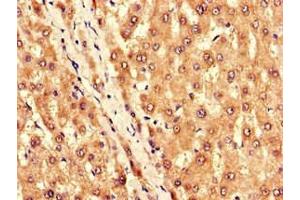 Immunohistochemistry of paraffin-embedded human liver tissue using ABIN7145021 at dilution of 1:100 (KCNJ11 antibody  (AA 172-390))
