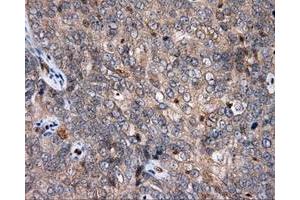 Immunohistochemical staining of paraffin-embedded Kidney tissue using anti-APP mouse monoclonal antibody. (APP antibody)