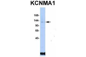 Host:  Rabbit  Target Name:  KCNMA1  Sample Type:  Jurkat  Antibody Dilution:  1. (KCNMA1 antibody  (C-Term))