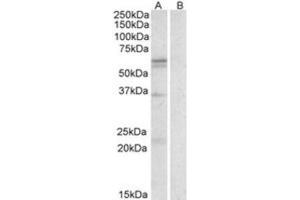 Western Blotting (WB) image for anti-Solute Carrier Family 7 (Cationic Amino Acid Transporter, Y+ System), Member 5 (SLC7A5) (Internal Region) antibody (ABIN2464279) (SLC7A5 antibody  (Internal Region))