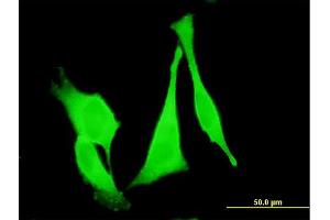 Immunofluorescence of monoclonal antibody to FZD3 on HeLa cell. (FZD3 antibody  (AA 55-157))
