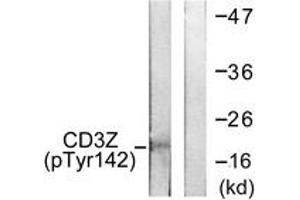 Western blot analysis of extracts from Jurkat cells treated with UV 15', using CD3 zeta (Phospho-Tyr142) Antibody.