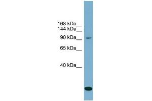 WB Suggested Anti-SLC12A4  Antibody Titration: 0. (SLC12A4 antibody  (N-Term))