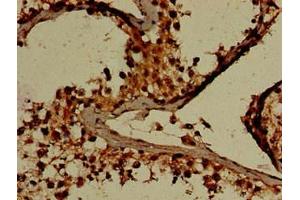 Immunohistochemistry of paraffin-embedded human testis tissue using ABIN7154194 at dilution of 1:100 (GARS antibody  (AA 1-389))