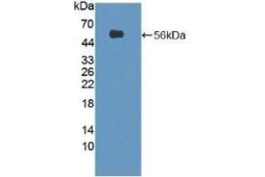 Detection of Recombinant SESN1, Mouse using Polyclonal Antibody to Sestrin 1 (SESN1) (SESN1 antibody  (AA 45-492))