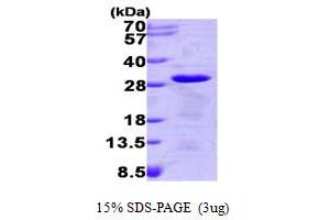 SDS-PAGE (SDS) image for Tumor Protein, Translationally-Controlled 1 (TPT1) (AA 1-172) protein (His tag) (ABIN666938)
