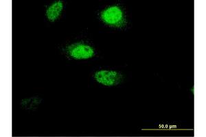 Immunofluorescence of monoclonal antibody to RNF207 on HeLa cell. (RNF207 antibody  (AA 135-244))