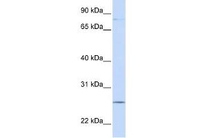 WB Suggested Anti-PCDHGC3 Antibody Titration:  0. (Protocadherin gamma Subfamily C, 3 (PCDHGC3) (N-Term) antibody)