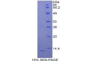 SDS-PAGE (SDS) image for S100 Calcium Binding Protein B (S100B) (AA 1-92) protein (His tag) (ABIN1080768) (S100B Protein (AA 1-92) (His tag))