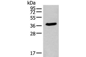 Western blot analysis of HEPG2 cell lysate using ACBD4 Polyclonal Antibody at dilution of 1:400 (ACBD4 antibody)