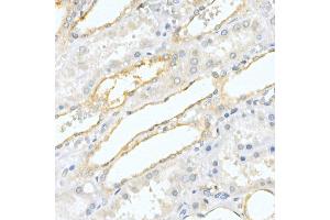 Immunohistochemistry of paraffin-embedded human kidney using Prostatic Acid Phosphatase (ACPP) Rabbit pAb (ABIN3022671, ABIN3022672, ABIN3022673 and ABIN6219082) at dilution of 1:50 (40x lens). (ACPP antibody  (AA 40-300))