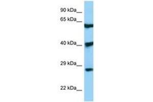 Image no. 1 for anti-DKK3 (AA 51-100) antibody (ABIN6748413)