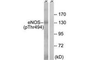 Western blot analysis of extracts from Jurkat cells, using eNOS (Phospho-Thr494) Antibody. (ENOS antibody  (pThr495))