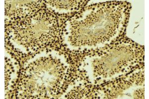ABIN6268696 at 1/100 staining Mouse testis tissue by IHC-P. (EZH2 antibody  (Internal Region))