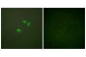 Immunofluorescence analysis of NIH/3T3 cells, using Sumo1 antibody. (SUMO1 antibody  (N-Term))