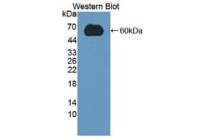 Western blot analysis of the recombinant protein. (LDLR antibody  (AA 263-509))