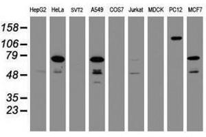 Image no. 2 for anti-Receptor (TNFRSF)-Interacting serine-threonine Kinase 1 (RIPK1) (AA 133-422) antibody (ABIN1490912) (RIPK1 antibody  (AA 133-422))