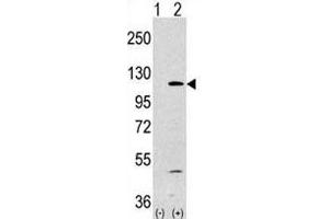 Western blot analysis of PI3KCA antibody and 293 lysate transiently transfected with the PIK3CA gene (1ug/lane). (PIK3CA antibody  (AA 504-533))