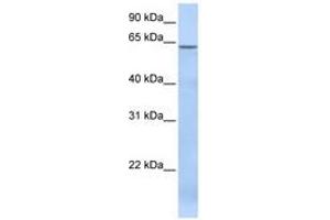 Image no. 1 for anti-TBC1 Domain Family, Member 22A (TBC1D22A) (AA 108-157) antibody (ABIN6741275) (TBC1D22A antibody  (AA 108-157))