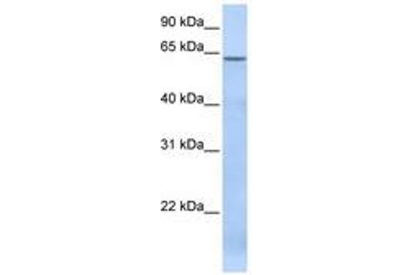 TBC1D22A 抗体  (AA 108-157)