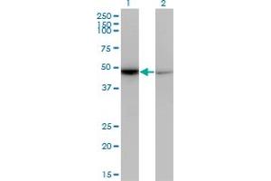 Western Blot analysis of NR0B1 expression in transfected 293T cell line by NR0B1 monoclonal antibody (M07), clone 3G8. (NR0B1 antibody  (AA 361-470))