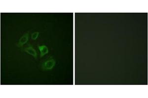Immunofluorescence analysis of HepG2 cells, using c-Met (Phospho-Tyr1003) antibody. (c-MET antibody  (pTyr1003))