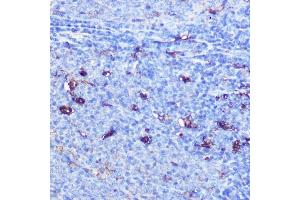 Immunohistochemistry of paraffin-embedded rat spleen using GSDMD Rabbit pAb  at dilution of 1:100 (40x lens). (GSDMD antibody)