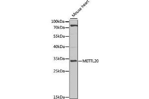 Western blot analysis of extracts of mouse heart, using METTL20 antibody (ABIN2563850) at 1:1000 dilution. (METTL20 antibody)