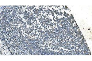 IHC analysis of TIMM8A/DDP using anti-TIMM8A/DDP antibody (ABIN7600039).