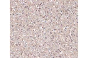 Immunohistochemistry of paraffin-embedded Rat liver using HSF1 Polyclonal Antibody at dilution of 1:100 (40x lens).