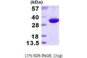 SDS-PAGE (SDS) image for gamma-Glutamyl Hydrolase (Conjugase, Folylpolygammaglutamyl Hydrolase) (GGH) (AA 25-318) protein (His tag) (ABIN667665) (GGH Protein (AA 25-318) (His tag))
