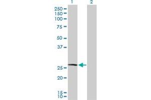 Western Blot analysis of CLTA expression in transfected 293T cell line by CLTA MaxPab polyclonal antibody. (CLTA antibody  (AA 1-218))