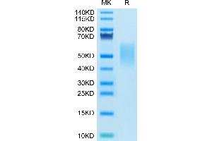 Mouse TIM-3 on Tris-Bis PAGE under reduced condition. (TIM3 Protein (AA 22-191) (His tag))