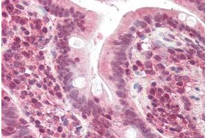Human Small Intestine (formalin-fixed, paraffin-embedded) stained with POLL antibody ABIN337014 at 5 ug/ml followed by biotinylated anti-goat IgG secondary antibody ABIN481715, alkaline phosphatase-streptavidin and chromogen. (POLL antibody  (AA 563-575))