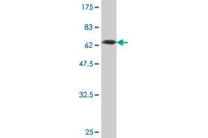 Western Blot detection against Immunogen (69. (Neuroserpin antibody  (AA 17-410))