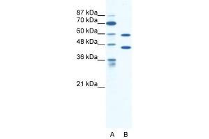 CATSPER2 antibody used at 1. (CATSPER2 antibody  (C-Term))