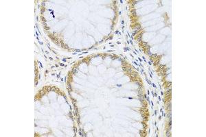 Immunohistochemistry of paraffin-embedded human colon using ARL6 antibody (ABIN5974886) at dilution of 1/100 (40x lens). (ARL6 antibody)