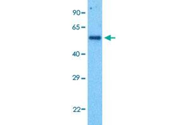 GABRD antibody  (N-Term)