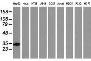 Western blot analysis of extracts (35 µg) from 9 different cell lines by using anti-SULT2A1 monoclonal antibody. (SULT2A1 antibody)