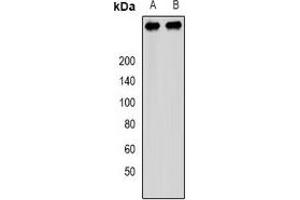 Western blot analysis of PCM1 expression in SW480 (A), 293T (B) whole cell lysates.