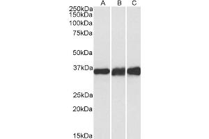 ABIN5539548 (0. (LDHB antibody  (Internal Region))