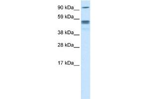 WB Suggested Anti-SEPT4 Titration:  0. (Septin 4 antibody  (N-Term))